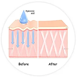 Hyaluronic Acid Matrix